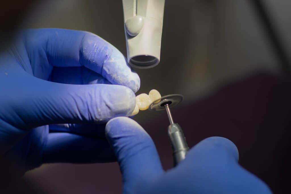 Customised Dental Solutions: Crowns, Aligners, and Implants Royal Tunbridge Wells