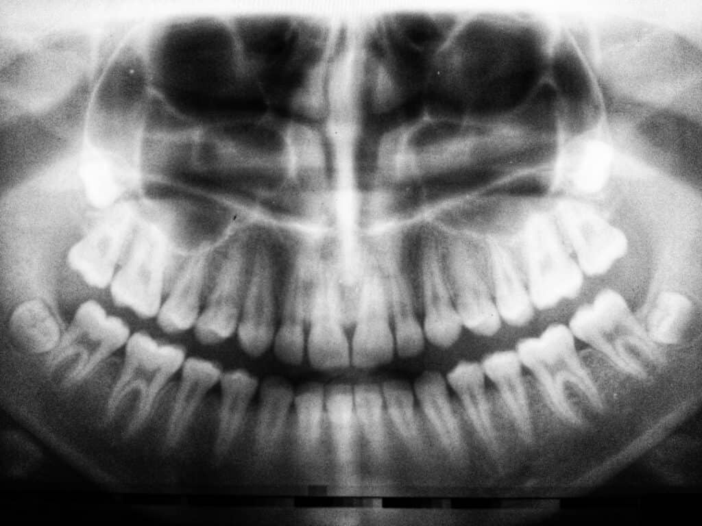 The Future of 3D Printing in Oral Healthcare Royal Tunbridge Wells